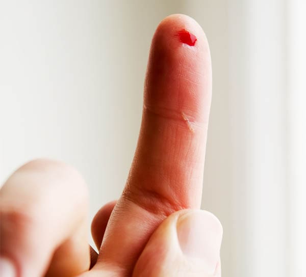 bleeding fingertip after being pricked by something sharp